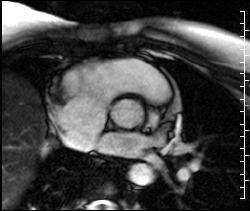 this gif has everything: heart, medical, valve, mri!