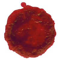 puraquiteria