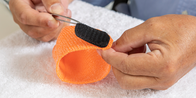 Orfit splinting