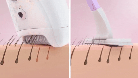 Resultado de imagen de epilator GIF