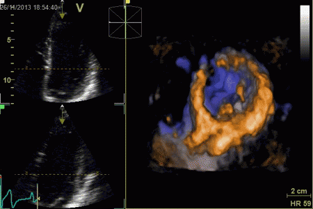 4d view ultrasound file 4d view ultrasound file