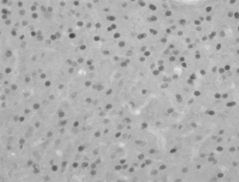 Stages of SCC Processing