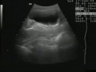 Así se ve el sexo en una cámara de ultrasonido