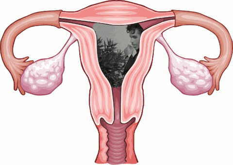 Prince Uterus GIF by Lady Parts Justice