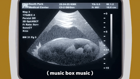 ultrasound image capture