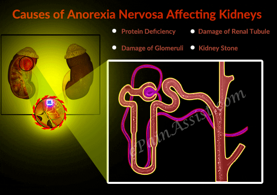 Anorexia Nervosa GIFs - Find & Share on GIPHY