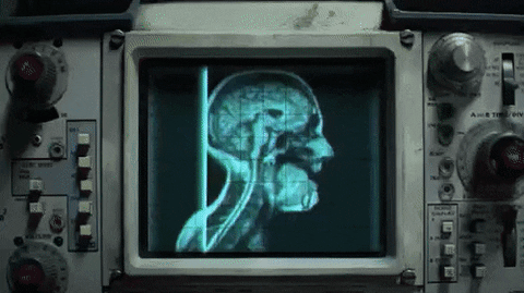 Brain Scan GIFs - Find & Share on GIPHY