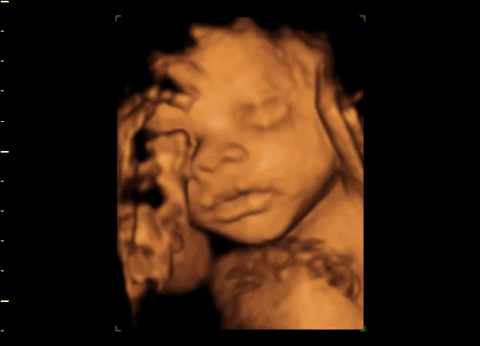 ecografie bebelus saptamana 28 de sarcina