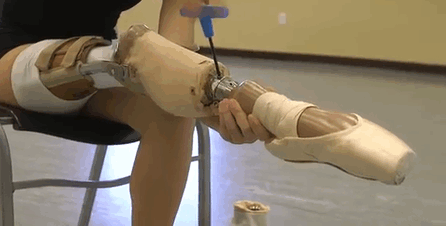 15-летняя балерина без ноги, балет девочка с протезом, танцует с протезом