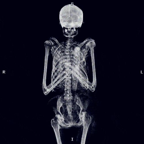 Skeleton Xray Gif Find Share On Giphy