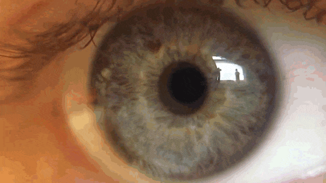 Nystagmus GIFs - Find & Share on GIPHY