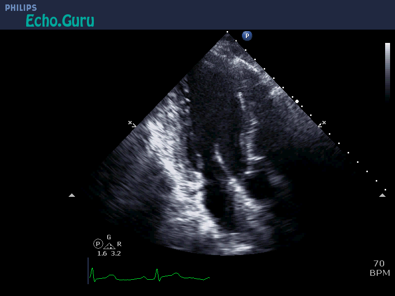 View GIF Find & Share on GIPHY