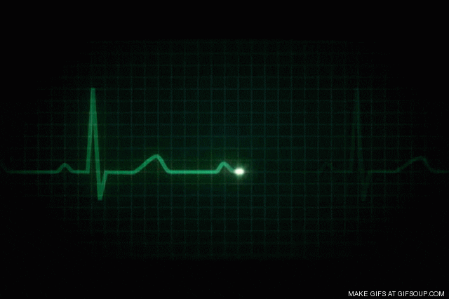 Resultado de imagen para electrocardiograma gif