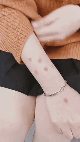 Mückenschutz Armband test 
