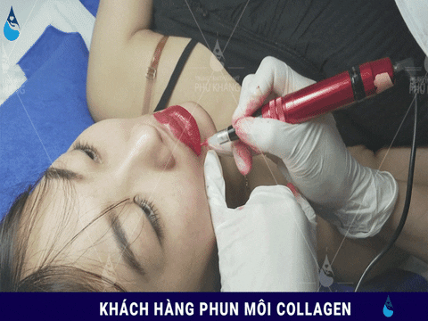 phun môi collagen tại Phú khang như thế nào
