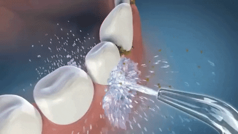 Irrigador Oral Portátil - Dental Luminous – Importasonho