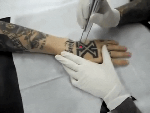Mitos y verdades de los tatuajes borrar