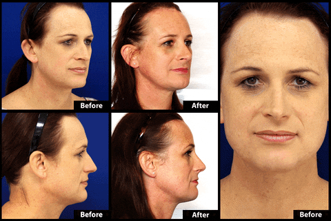  Before And After GIF - Find & Share on GIPHY