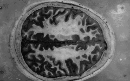 Slika aktivnosti v možganih