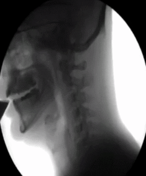 Porn Deep Throat X Ray | Sex Pictures Pass