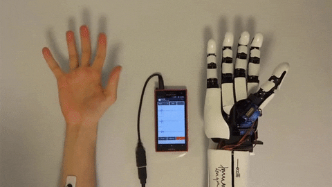 control arm smartphone muscle bionic