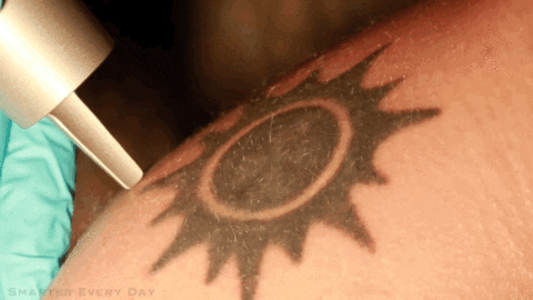 Laser Removal GIF - Find &amp; Share on GIPHY