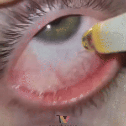 GIF