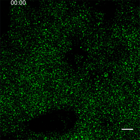 Field of hundreds or thousands of cells glow green against a black background