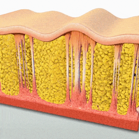 Appareil Anti-Cellulite 3 en 1