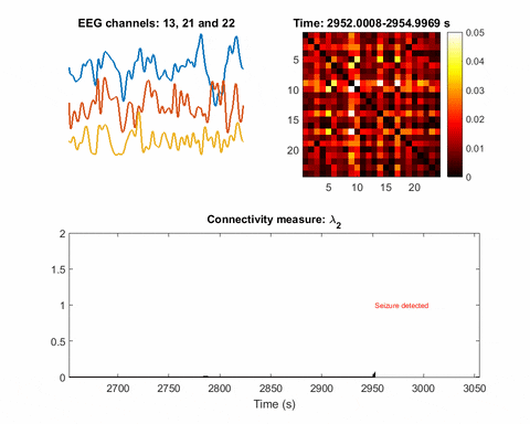 EEG information speeds by as another block shows red, yellow, and black dots lighting up over time. The final block shows "connectivity measure" changes over time via a black-on-white graph