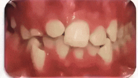 Teeth management
