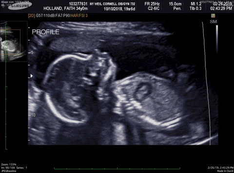 Birth Announcement GIFs Get The Best GIF On GIPHY Birth Announcement GIFs Get The Best GIF On GIPHY