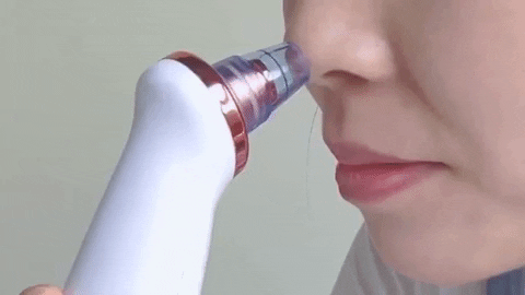 Nose Blackhead Remover For Beauty – SassyNelly