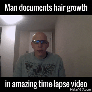 Man Document hair growth in funny gifs