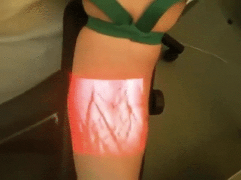 venipuncture