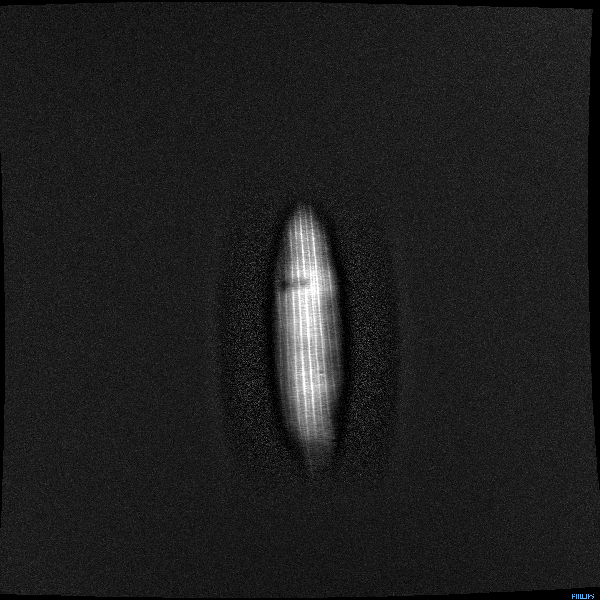 Corn Mri GIF Find & Share on GIPHY