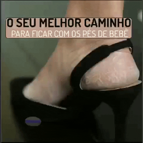 Removedor de calos e rachaduras – Outbox50%