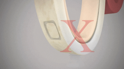 Chirurgie dentara Chirurgie dentara Chirurgie dentara Chirurgie dentara