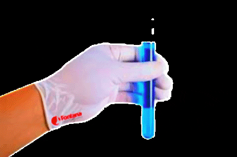 Pap Smear Test in Dubai