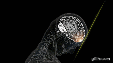 Hoạt ảnh mô phỏng nguyên nhân chấn động não (theo quan điểm cũ).