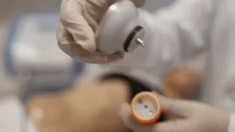 Radiofrequencia: vamos tratar estrias, celulites e gorduras localizadas 4 Outra área de aplicação bastante requisitada é no abdomen