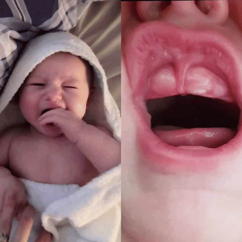 tanda bayi tumbuh gigi