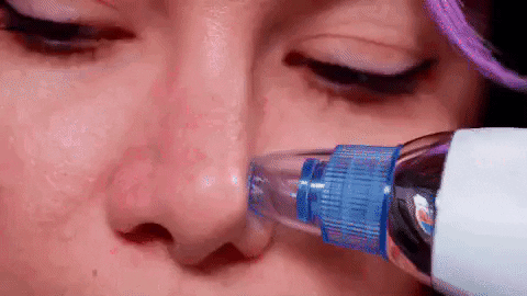 SkinPRO - Removedor de Cravos e Espinhas por Sucção – Litoral Shop