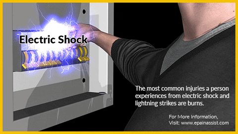 Electric Shock Causes GIFs - Find & Share on GIPHY