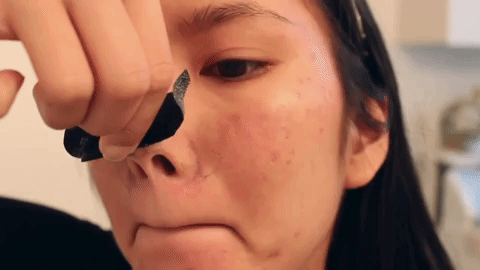 ENTITY reports on how to get rid of blackheads.