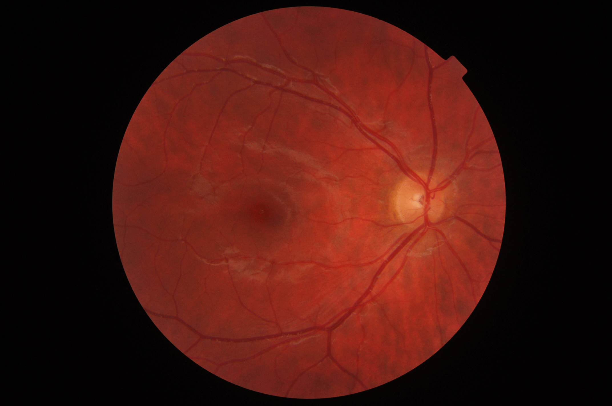 Scan GIFs Find & Share on GIPHY