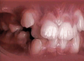  teeth GIF