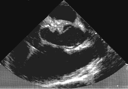 send nudes cardiograph gif send nudes cardiograph gif
