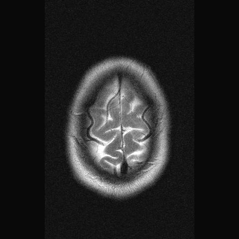 brain scan brainscan