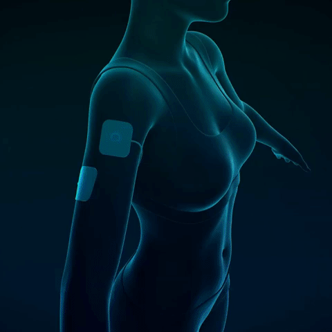 Demonstrasjon av hvordan TENS terapi fungerer mot smerter